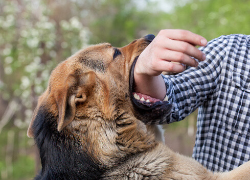 A dog playfully bites a person's arm wearing a checkered shirt. The dog's mouth is open wide, gently holding the arm. The background is blurred greenery, suggesting an outdoor setting.